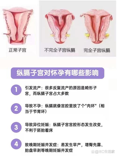 试管纵隔子宫