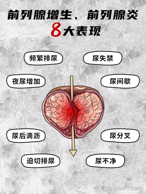 男性问题