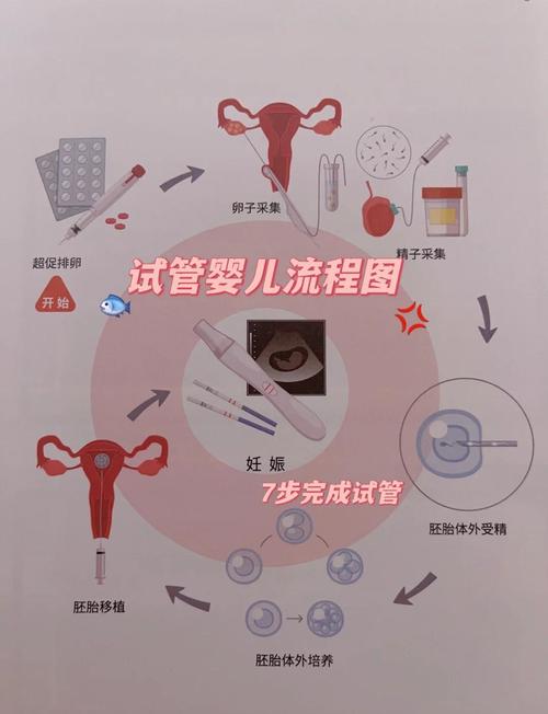  助孕技术