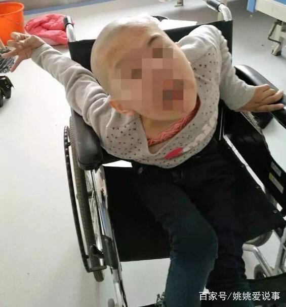 身体变形