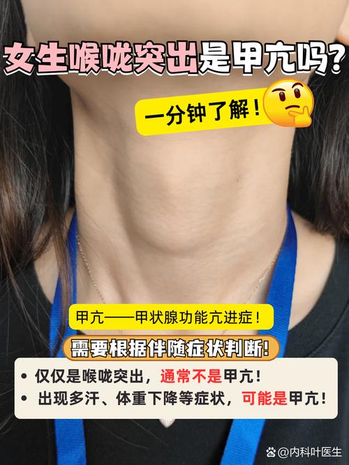 甲状腺功能亢进