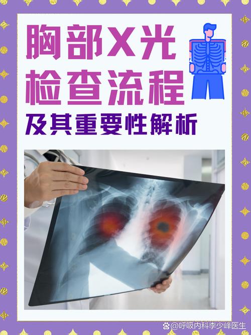 试管移植后为何可以进行胸片检查？