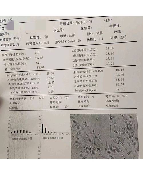 男子弱精