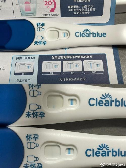 一促二移试管
