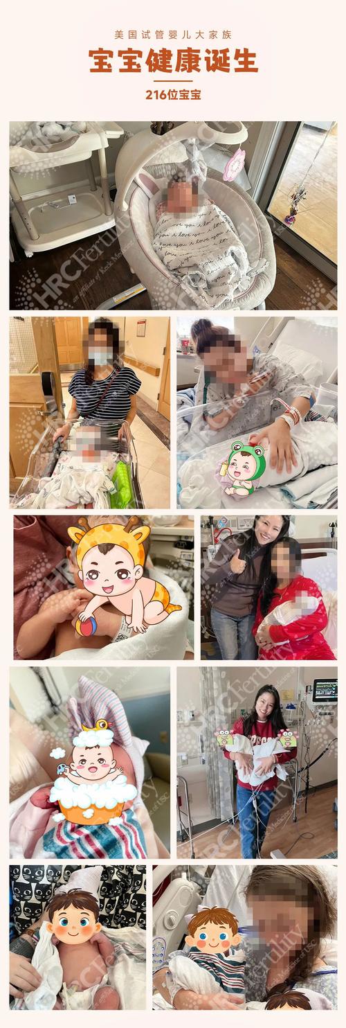 试管婴儿必然需要剖腹产吗？深入分析与真实案例