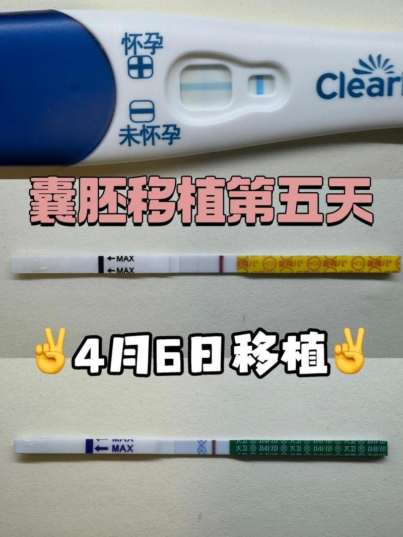 五天裂胚移植