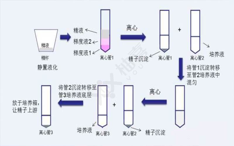 洗精术