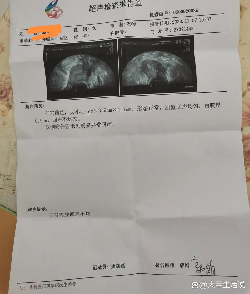 女性内膜检查