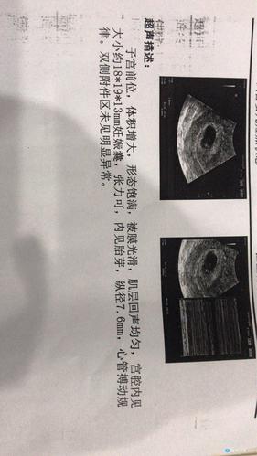 试管婴儿一个月