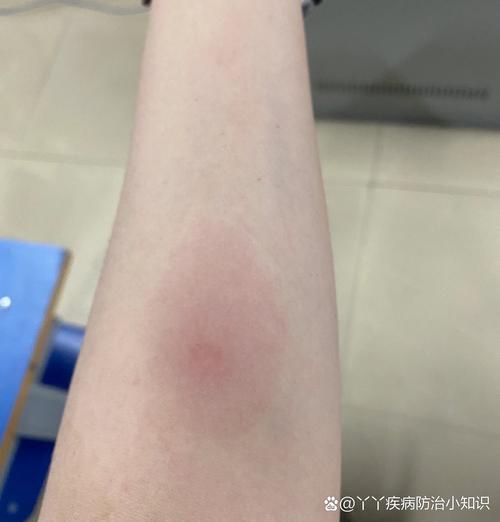强阳反应