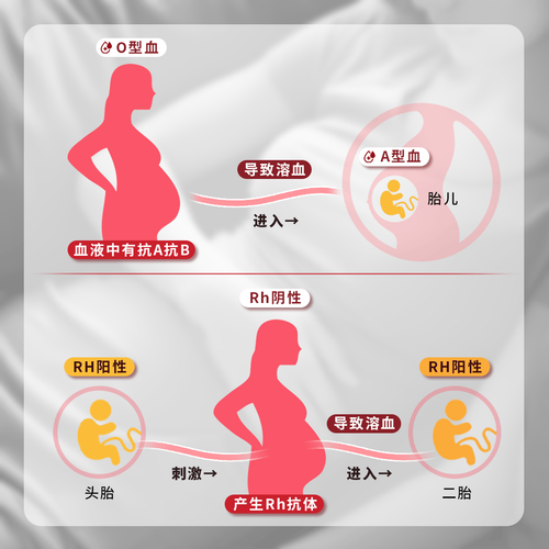 试管宝宝是否易发溶血现象？深入解读及建议