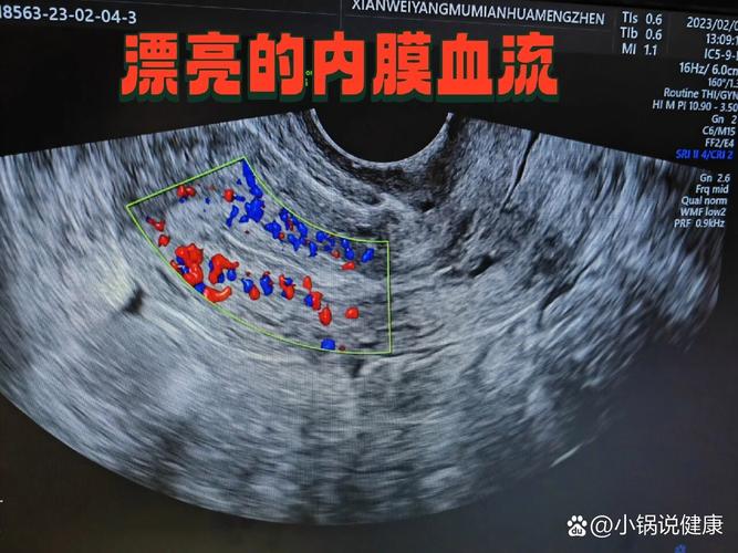 内膜血流