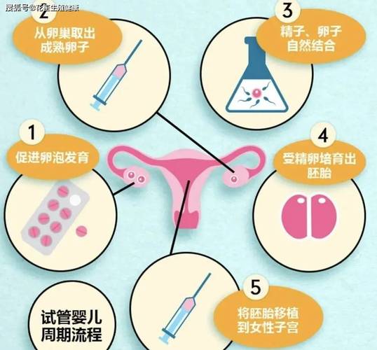 试管婴儿技术是否会影响宫颈健康？