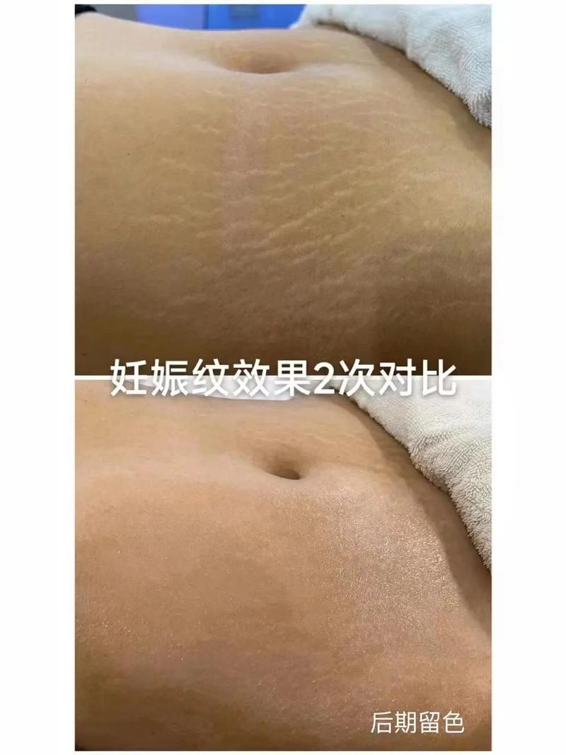 妊娠效果