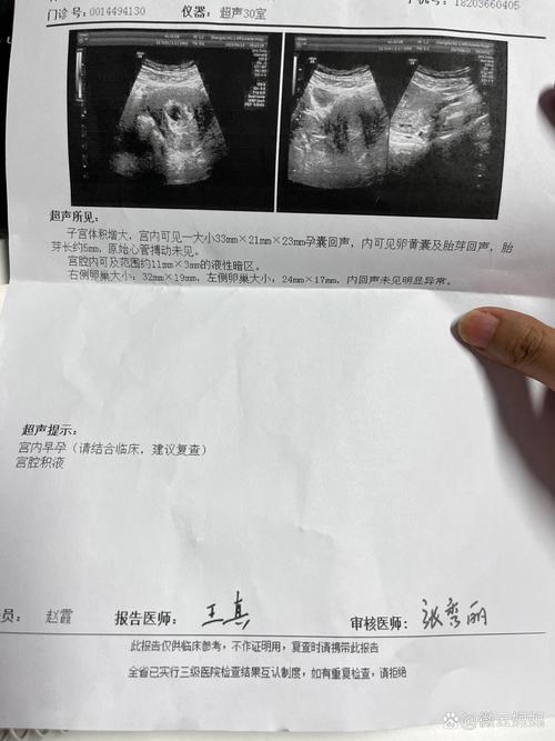 35天胎心图