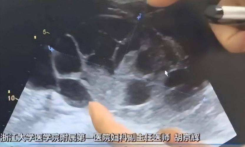 浙医医院能否提供试管婴儿服务？详解相关信息