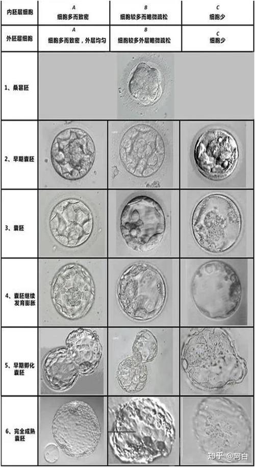  囊胚质量