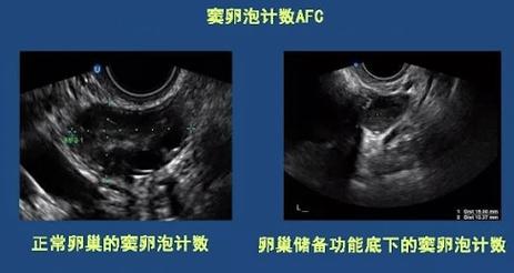 卵泡稀少