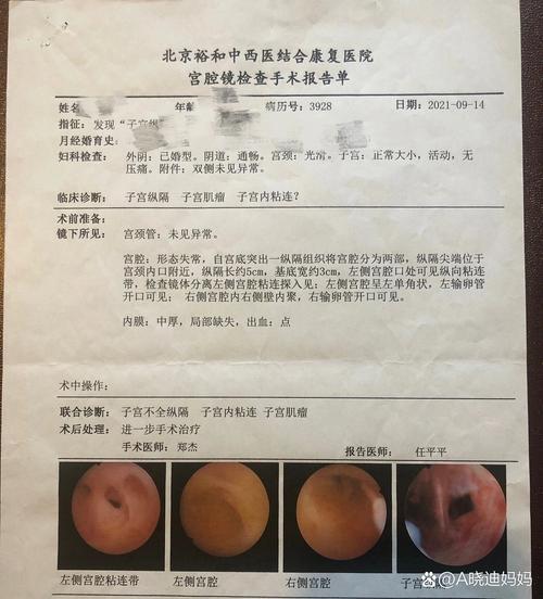 子宫纵膈手术后是否可以进行试管婴儿治疗？