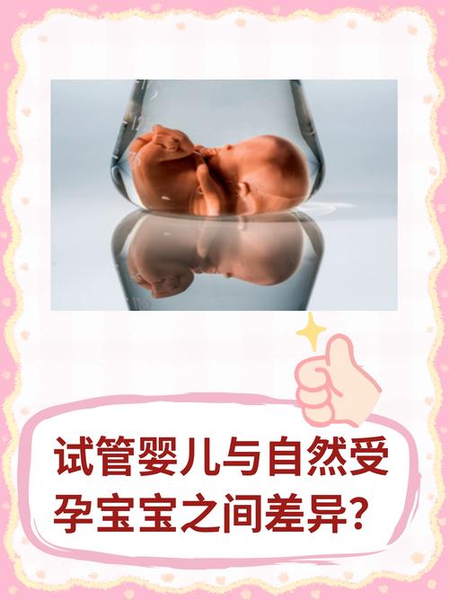 试管婴儿与自然受孕宝宝的差别有哪些？