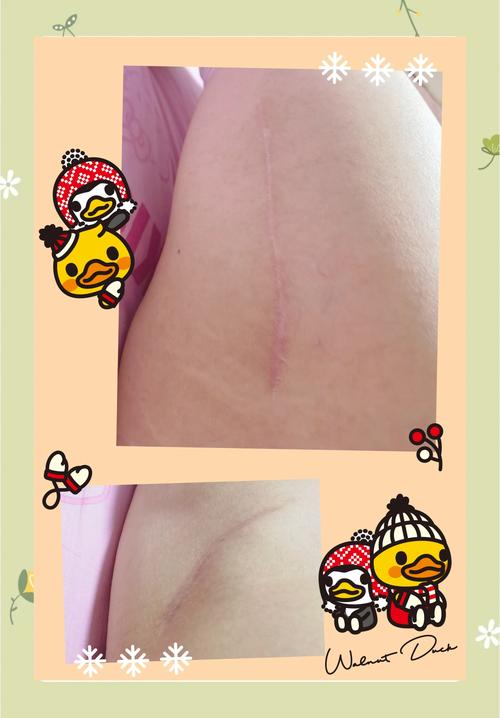术后身体变化