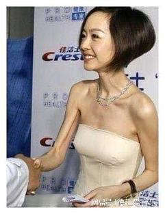 瘦人