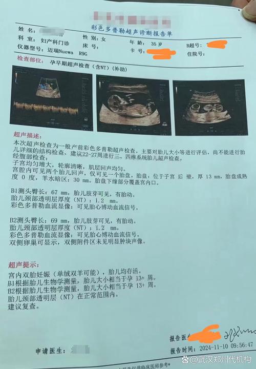 试管婴儿妊娠中哪些数值预示双胞胎即将到来？