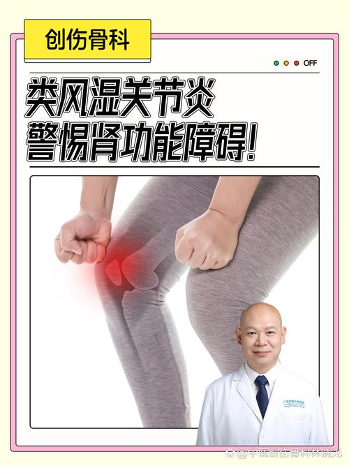 试管婴儿治疗是否会增加类风湿关节炎风险？