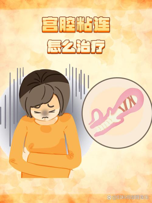 宫口粘连患者能否顺利进行试管婴儿治疗？