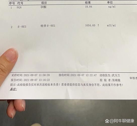 HCG 40