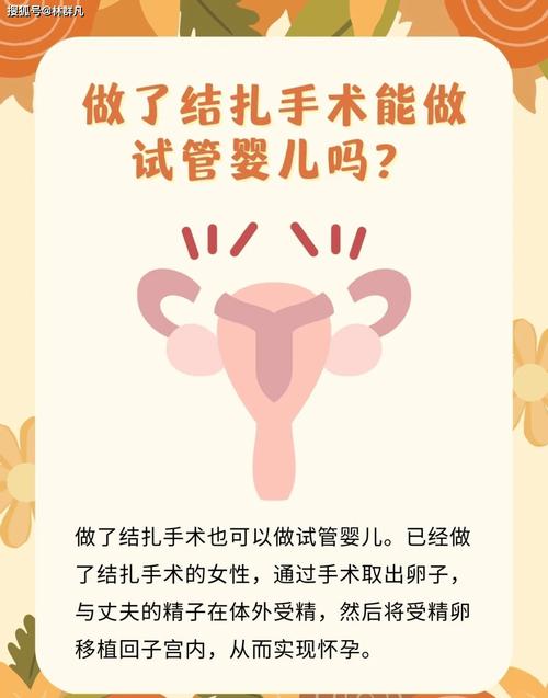 结了扎后还能进行试管婴儿吗？详细解析与注意事项