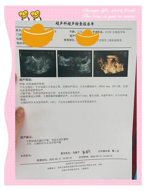 试管检查超声波能揭示哪些关键信息？