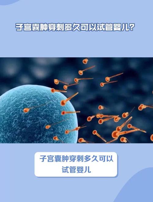 囊肿患者能否进行试管婴儿治疗？