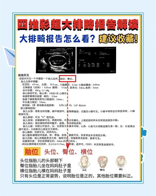 彩超单解读