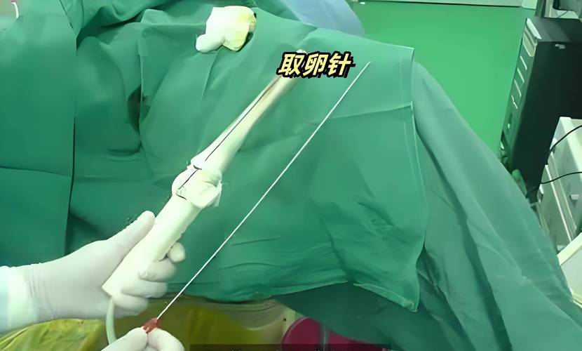 国内哪里做试管婴儿手术效果最好？全面解析