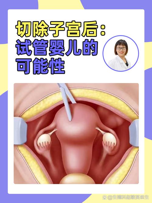 输卵管切除后多久可以尝试试管婴儿治疗？