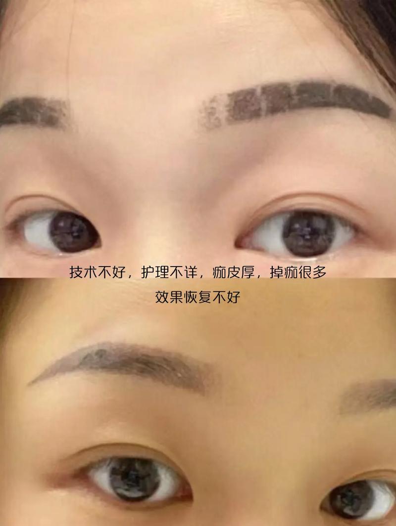  眉毛脱落