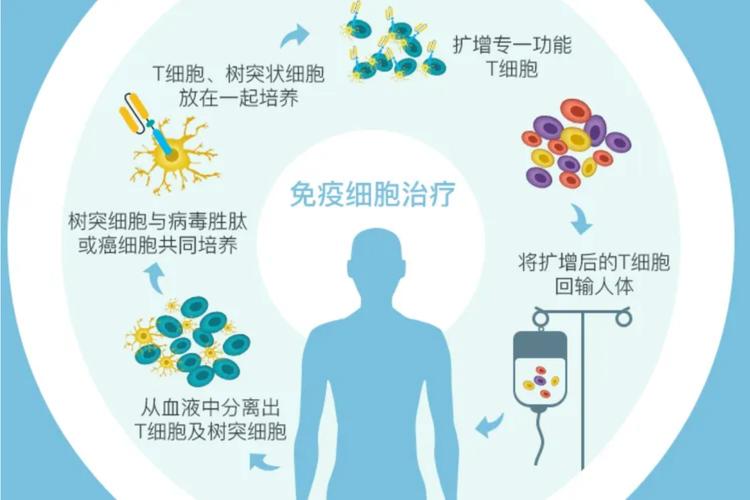 免疫治疗