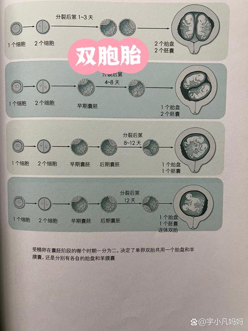 双胞胎规划