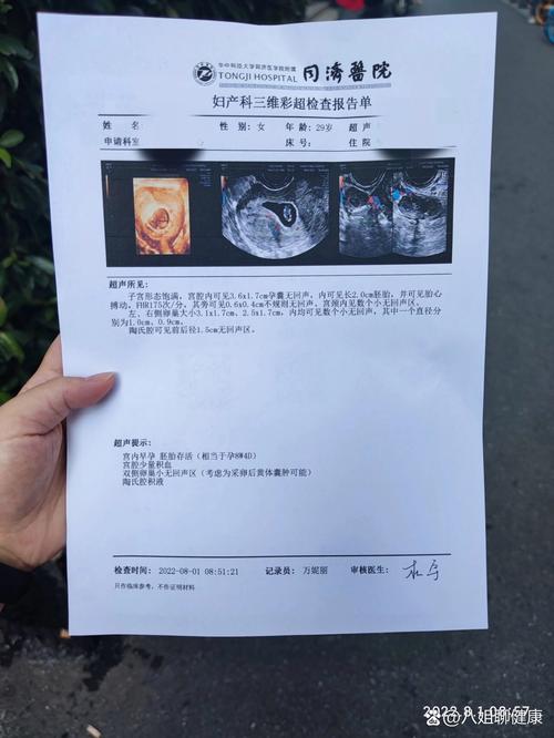 移植42天