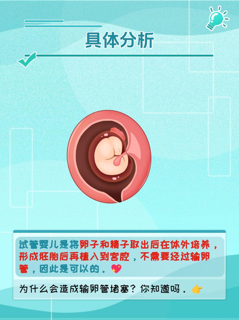 输卵管堵塞患者是否可以选择试管婴儿治疗？