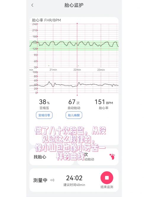 试管婴儿胎心率184正常吗？专家解读胎心变化