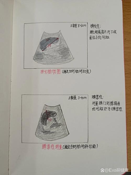 彩超图解析