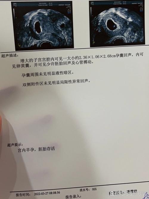 移植27天