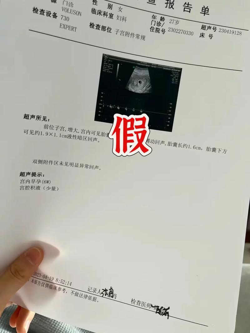 假怀孕