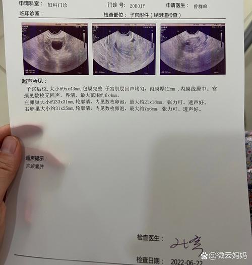  卵泡检测