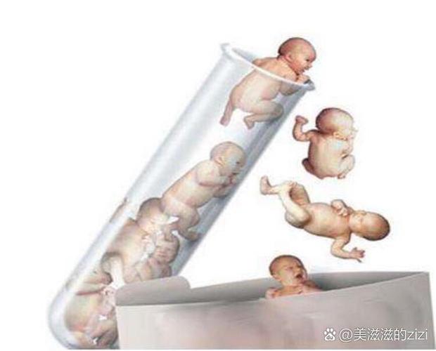 试管婴儿一代结合