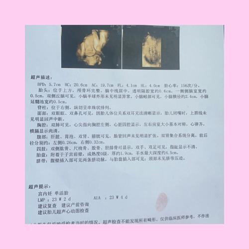 大排畸技术