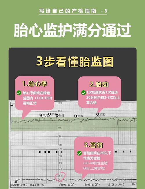 胎心解读
