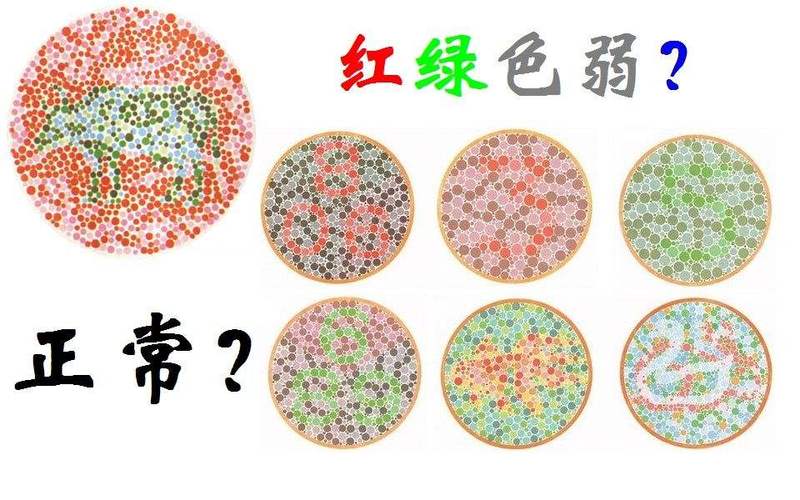 试管婴儿技术能否有效排除胎儿色盲基因?